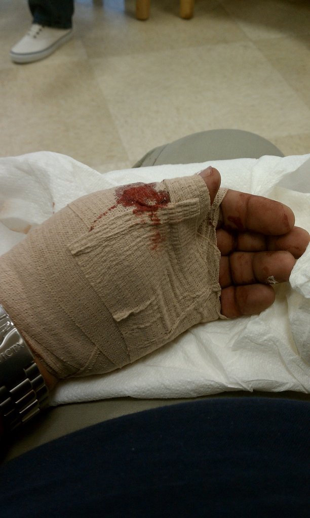 Мужик поранил руку (7 фото)