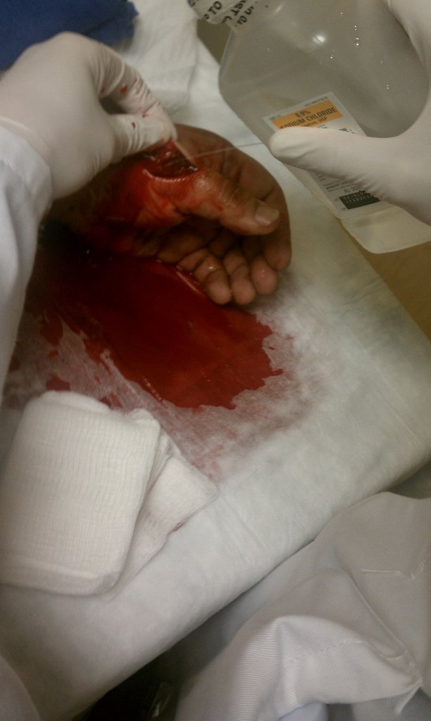 Мужик поранил руку (7 фото)