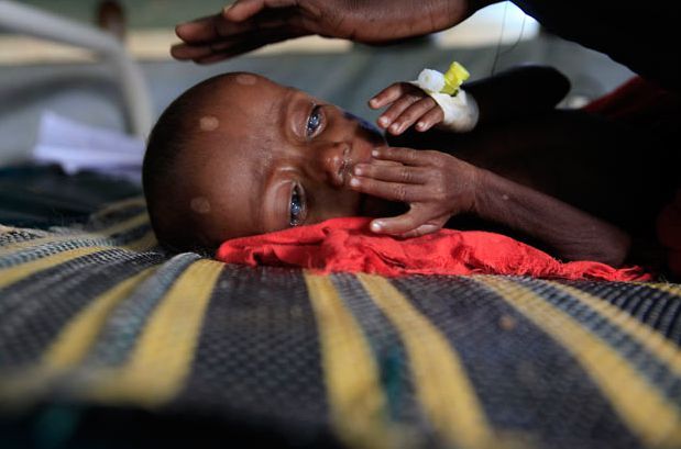 Голодающие дети  Африки(21 фото)