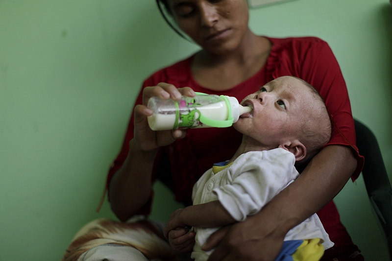25-летняя Тельма Наджера кормит своего страдающего от недоедания сына, по имени Минор, в больнице города Халапа, Гватемала. Президент Колумбии Альваро Колом заявил о том, что сложилось 
