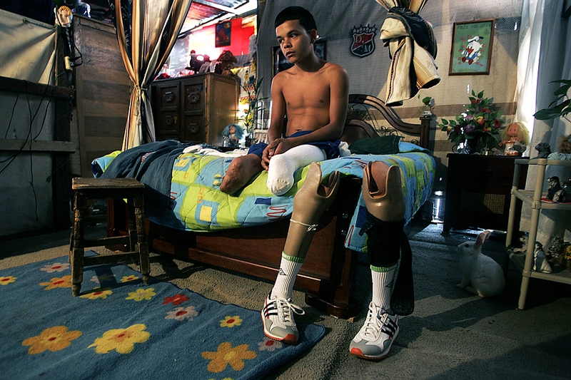 15-летний Джон Касас готовится к соревнованиям по легкой атлетике в колумбийском городе Медельин. Он готовится к участию в Паралимпийских играх в Лондоне в 2012 году. Мальчик потерял ноги в автомобильной аварии.