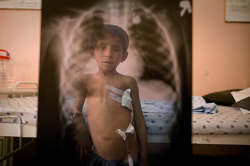 Фотография 7-летнего Аттиулаха, сделанная через рентгеновский снимок, в больнице афганского города Кандагара. Шальная пуля вошла в спину мальчика и вышла через грудь, когда он пас овец. Его дед утверждает, что ребенка подстрелили военные США, которые стреляли по автомобилю талибов.