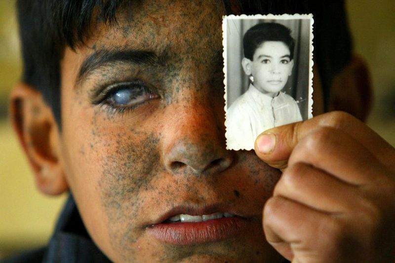 Иракский мальчик Айяд Алим Бриссам Карим показывает своё фото до случившегося. Американские вертолёты выпустили ракеты по полю, где он играл в тот момент, в результате он потерял зрение и получил ожоги