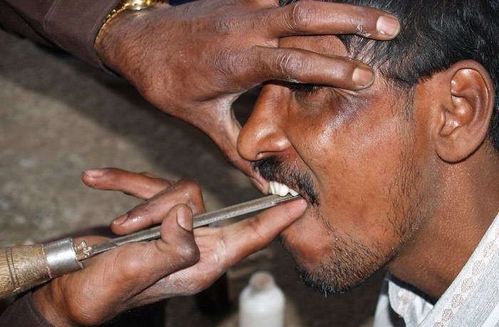 Уличный дантист в Индии (12 фото)