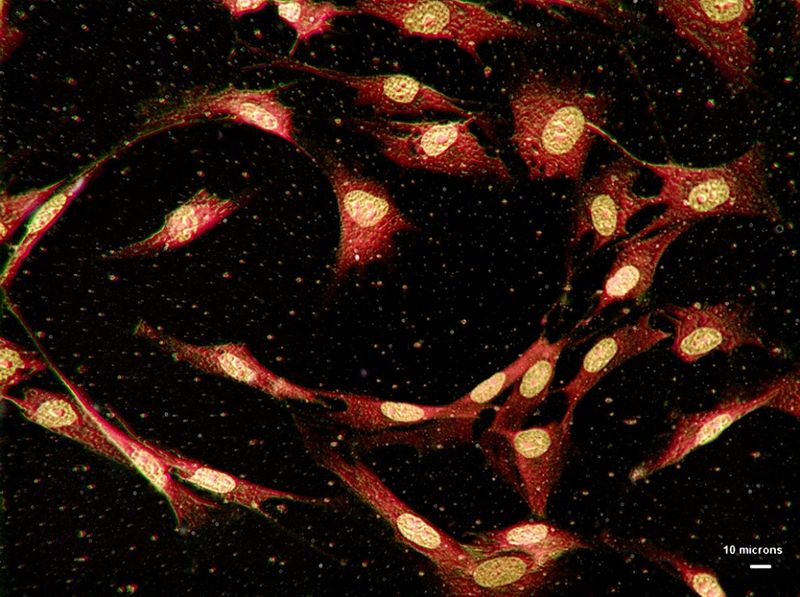 Среди других микроскопических снимков – вещества всего в нанометры в длину, невидимые невооруженным глазом, как, например, клетки костной ткани человека.