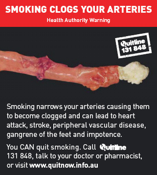Предупреждение о вреде курения на пачках сигарет со всего мира (50 фото)