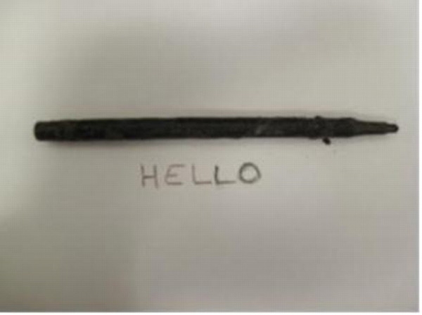 Ручка пролежала в желудке 25 лет (2 фото)