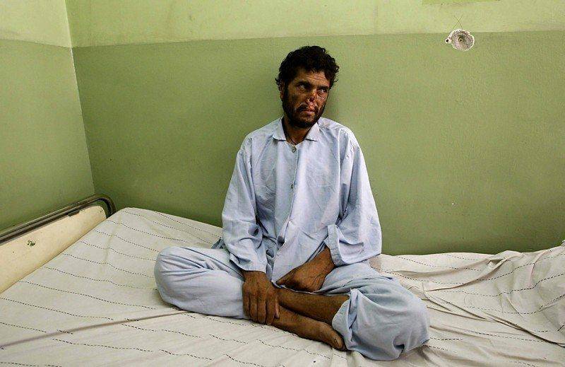 Лал Мохаммад, 40-летний крестьянин, общается с журналистами в кабульской больнице. Мохаммад стал одним из миллионов афганцев, которые не стали слушать угрозы талибов и пошли на избирательные участки во время президентских выборов 20 августа. Когда Лал шел домой с избирательного участка, на него напали боевики и отрезали ему часть носа и уши.