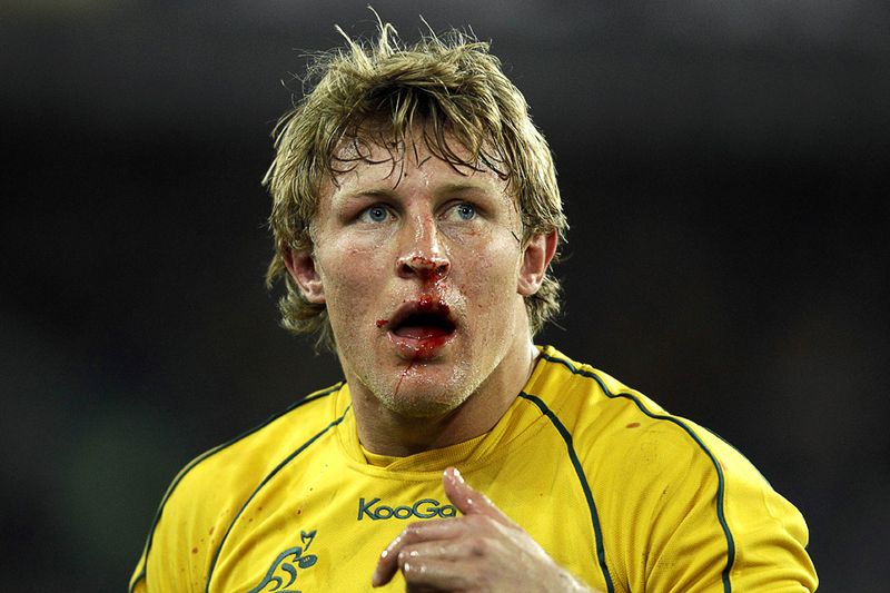 Австралийцу Лэчи Тернеру разбили нос в матче по регби против сборной Новой Зеландии в Сиднее 11 сентября. (AP Photo/Rick Rycroft)