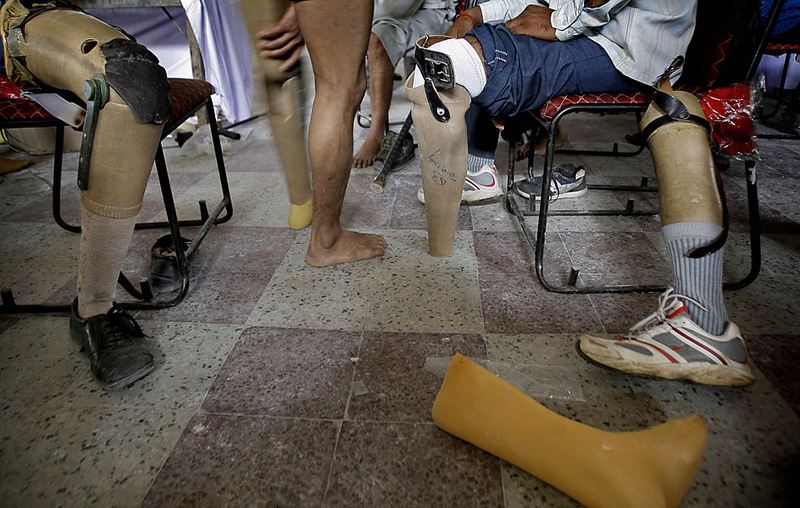Инвалиды ждут получения новых протезов в лагере инвалидов Джайпур в Нью-Дели. Лагерь был организован с целью бесплатного предоставления протезов и костылей для инвалидов.