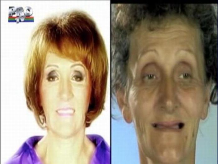 Румынское телешоу. До и после пластической операции (31 фото)