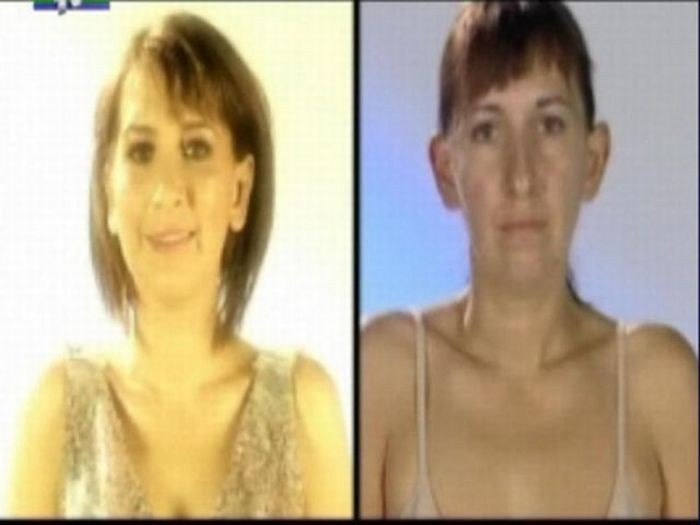 Румынское телешоу. До и после пластической операции (31 фото)
